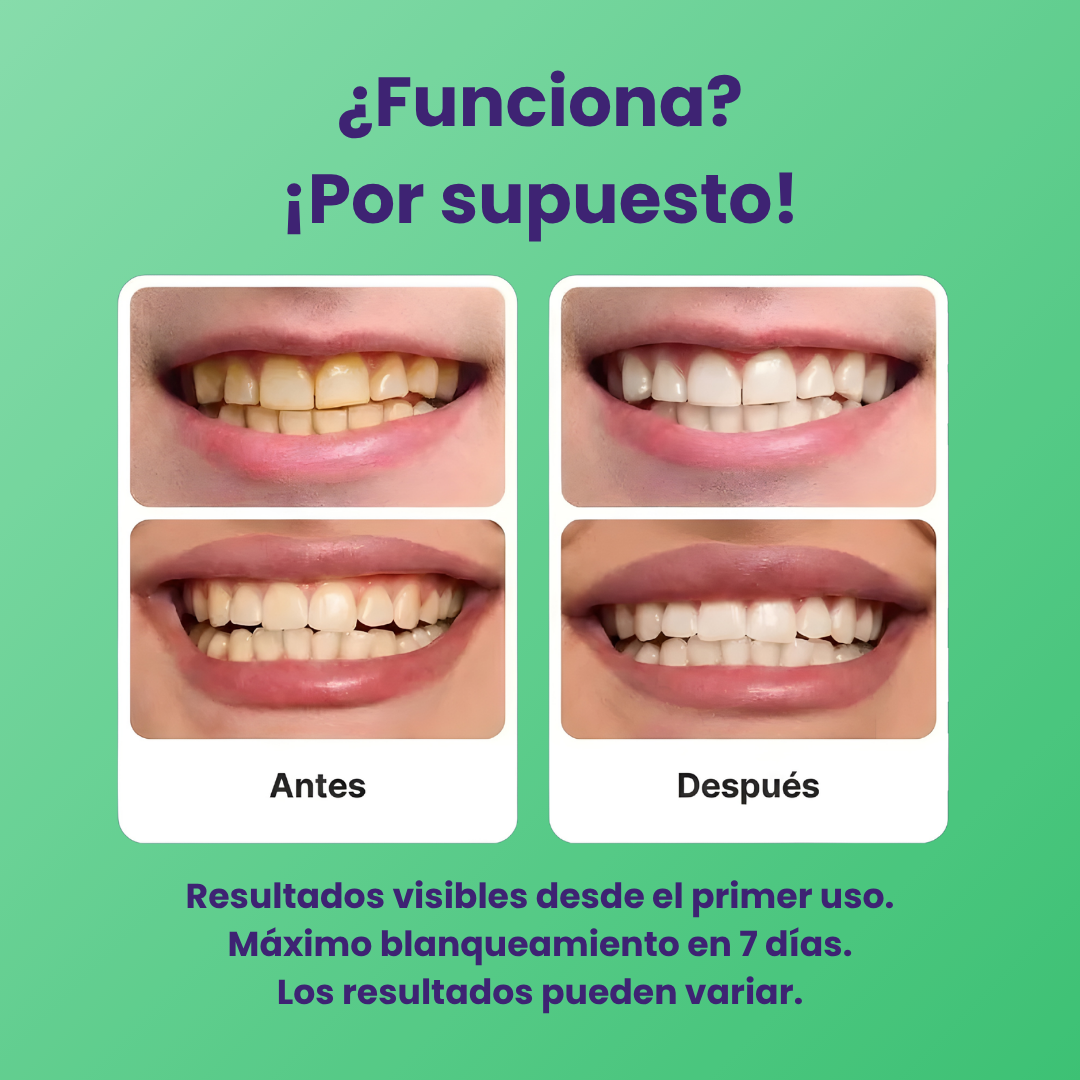 VittaSmile™ - Tiras blanqueadoras para dientes